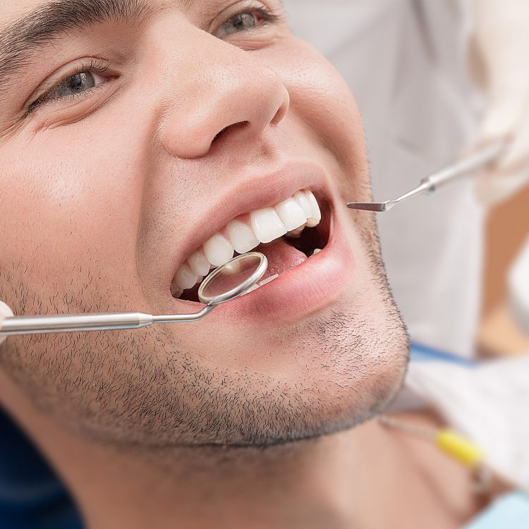 Porcelain veneers